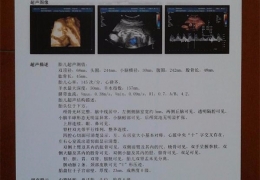 谈医用彩超胶片的运用室内环境有什么