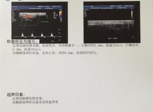 太仓医用B超胶片的作用