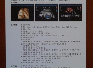 谈医用彩超胶片的运用室内环境有什么