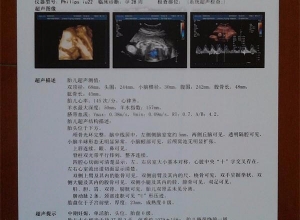 无锡谈医用彩超胶片的运用室内环境有什么