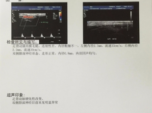 医用B超/放射胶片—医用激光胶片